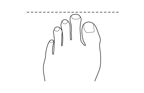 Big toe assessment