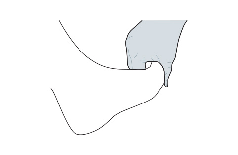 Everson fascial cord tension test