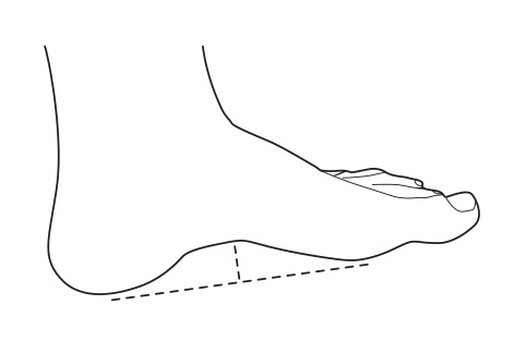 Weight bearing & non-weight bearing arch height tests